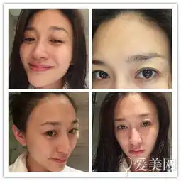 刘亦菲素颜逛街人显憔悴女星素颜大比拼
