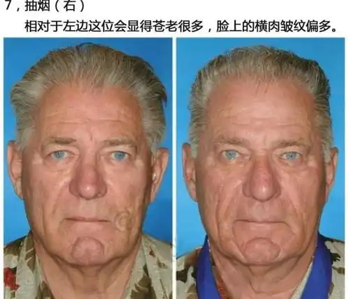 男人延缓衰老的6个好习惯,占得越多,衰老迟到得越久
