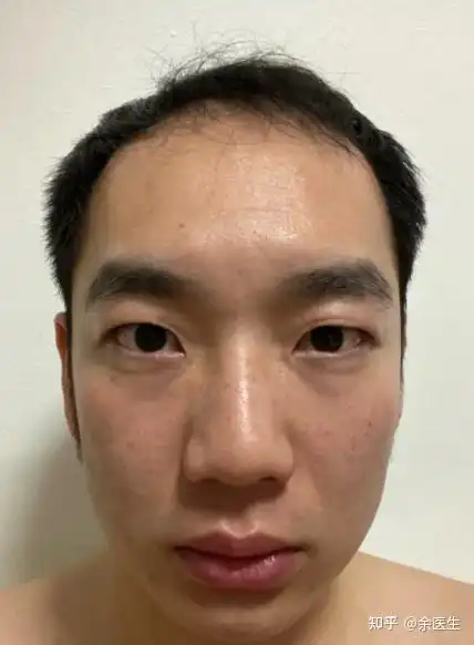 从医学的角度来说,男性到底该如何延缓衰老
