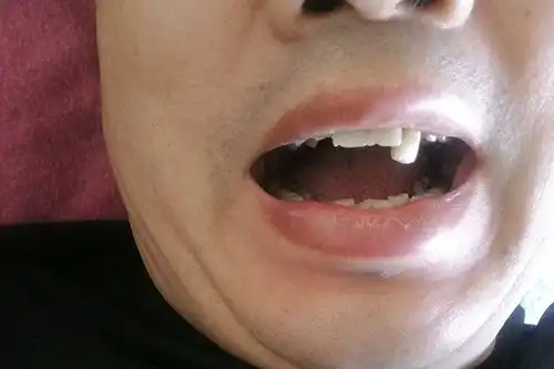 肾能力烂如泥的男人,身上3个表现特明显,难怪总让老婆失望
