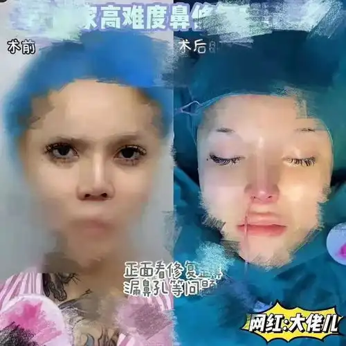 抖音百万粉美女网红竟然是男儿身
