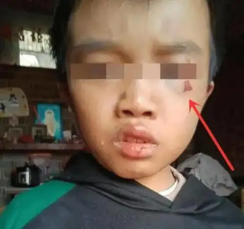 江西12岁男童被父母虐死,女方曾声称母爱伟大,今再怀孕妄想脱罪
