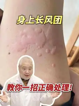 2024年过去了还在被前列腺增生困扰吗前列腺增生男性健康医学科普男科

