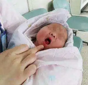 结婚6年终于怀孕,孩子出生有三颗牙,看完把医生吓了一跳
