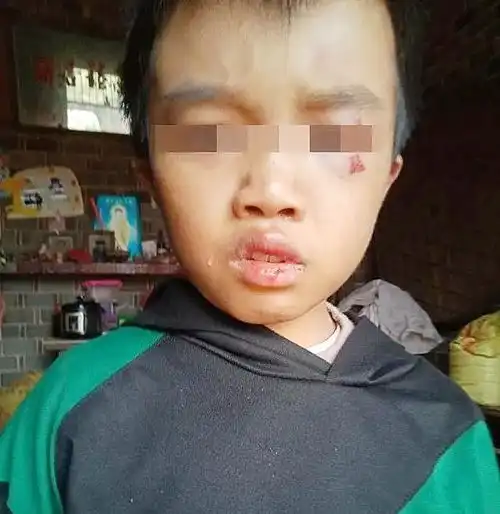 江西12岁男孩被父母虐打致死,弟弟8年前还被卖掉,两人已被刑拘
