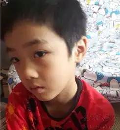费曼受伤左眼眉骨疤痕明显吴镇宇心痛组图
