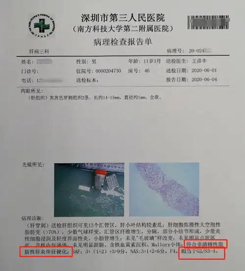 11岁肝硬化12岁脂肪肝,医生提醒把孩子吃得白白胖胖,其实是害了孩子
