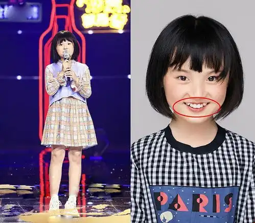 17岁男孩长尖牙,妈妈吐槽像吸血鬼,网友被咬一口很难辨别
