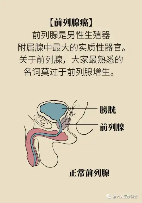 预防前列腺癌,男人们要做好六件事
