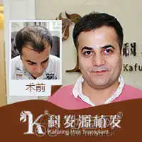 南昌那家种头发效果好男性脱发治疗可以使用什么方南昌美容美体
