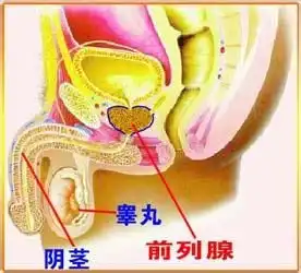 慢性前列腺炎的症状
