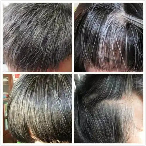 黑发神器不用染发就能让白发变黑发不伤头皮,三周助你还原秀发本色
