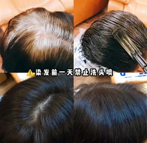 好物推荐意大利植物染发膏,能遮白发发色时髦,还不刺激头皮
